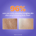 The Skin Reset Duo (Intensely Hydrating Gel Moisturizer - 100 gm | Exfoliating Body Wash - 236 ml)