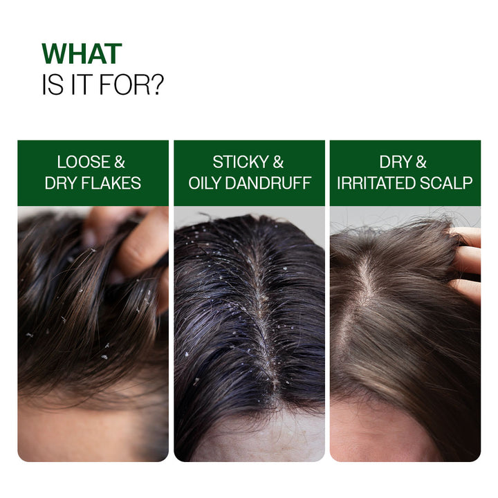 Advanced Anti Dandruff Serum with Salicylic Acid & Pentavitin - 50 ml