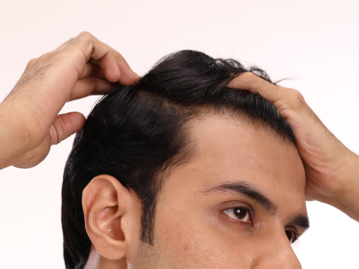 Step 2 image