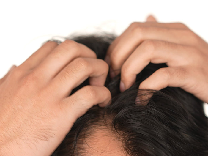 Step 2 image