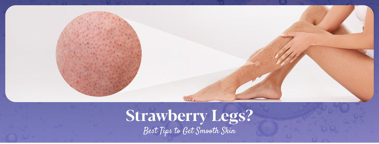 Strawberry Legs: Causes, Treatments & Tips to Prevent Them