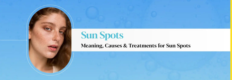 Sun Spots: Meaning, Causes & Treatments