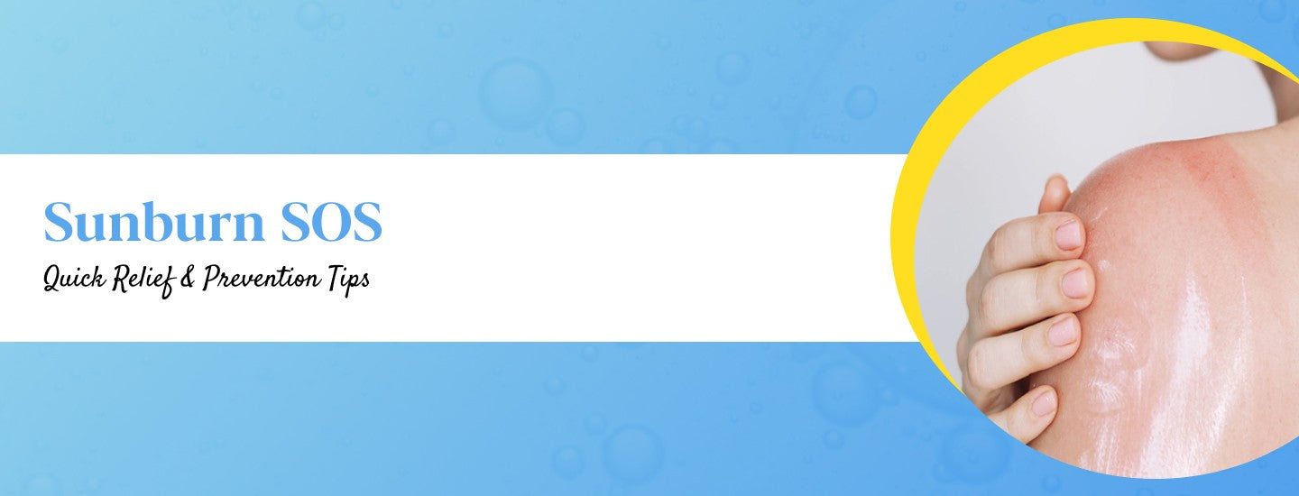 Sunburn in Summers: Causes,Treatment & Prevention Tips