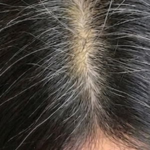 Grey Hair image