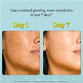 10% Vitamin C Serum for Glowing & Bright Skin - 30 ml