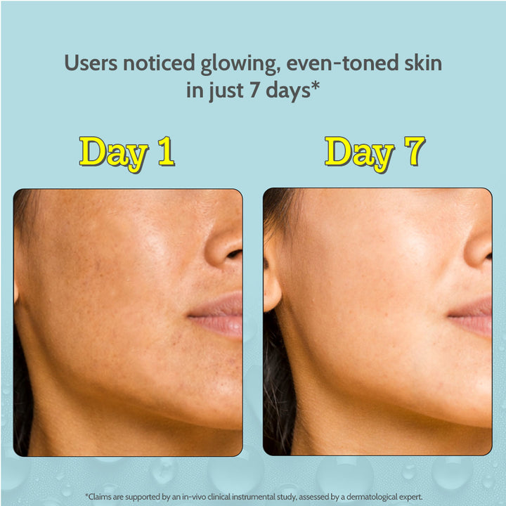 10% Vitamin C Serum for Glowing & Bright Skin - 30 ml